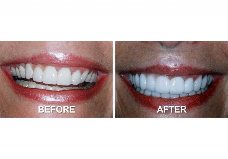Before and After Dental Services