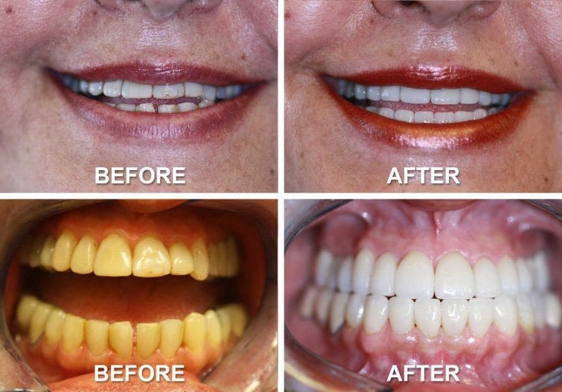 Best ABQ Dentist - Patient Smile