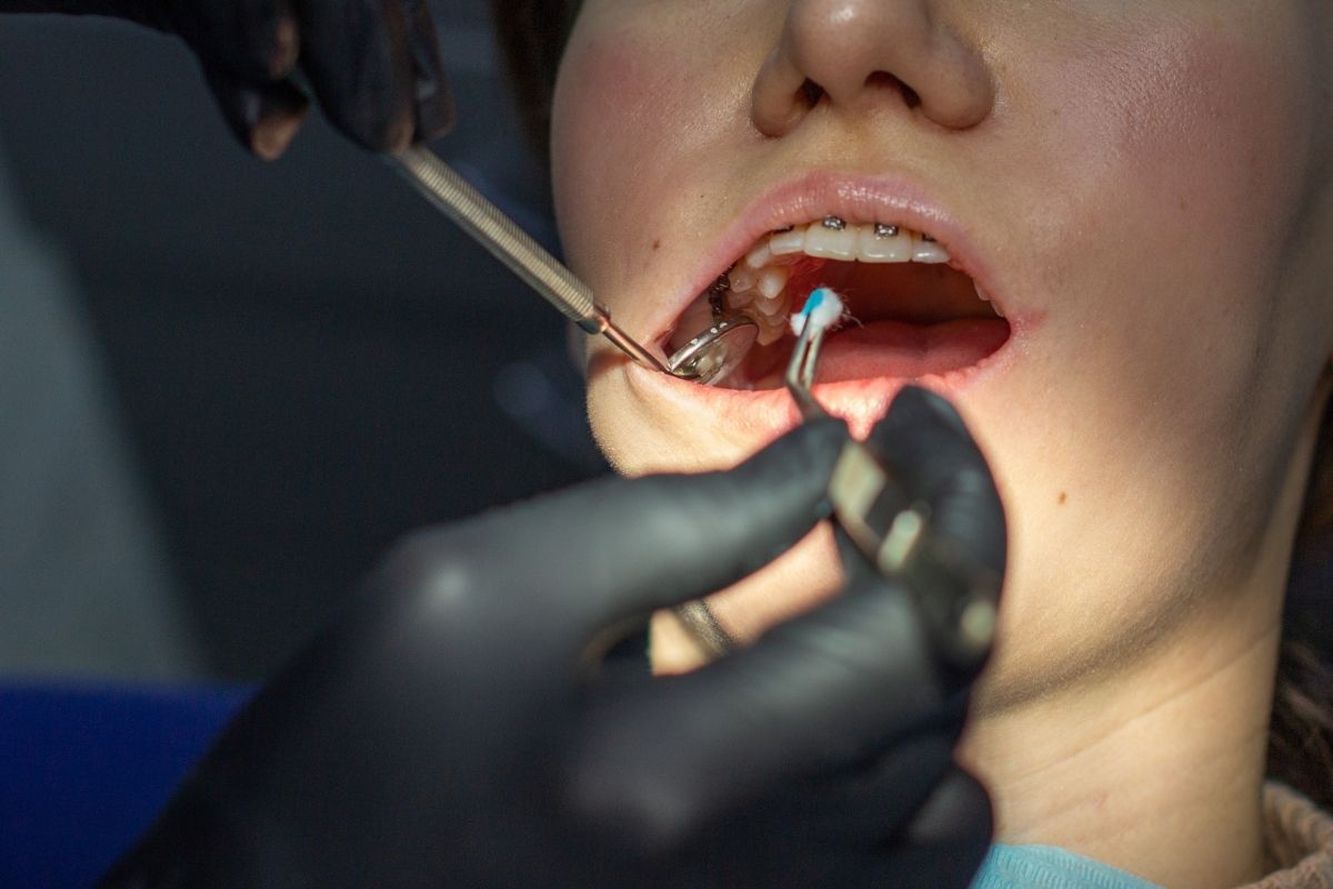 dental check up of women