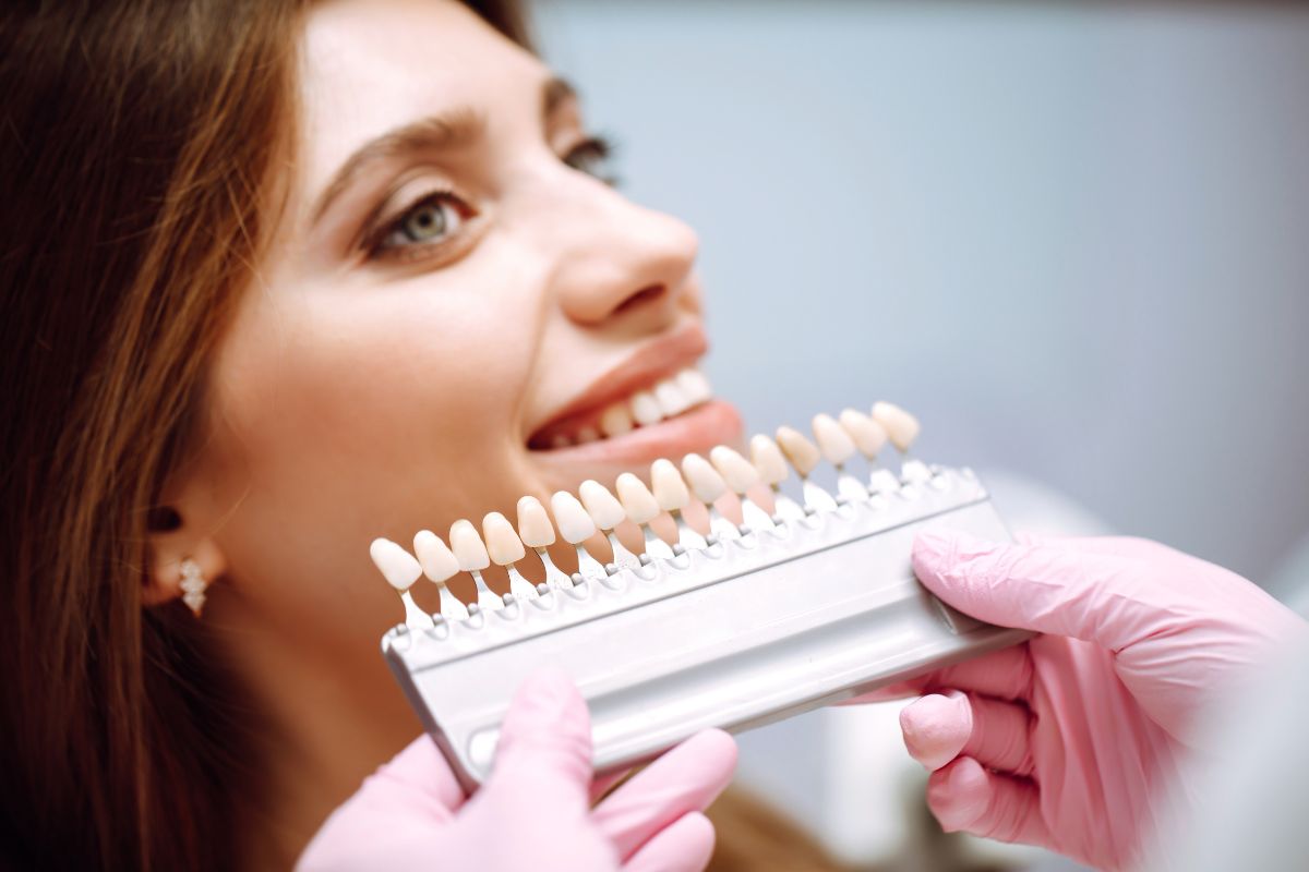 veneers maintenance tips